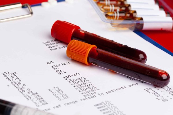 En quoi consiste le diagnostic loi Carrez ?